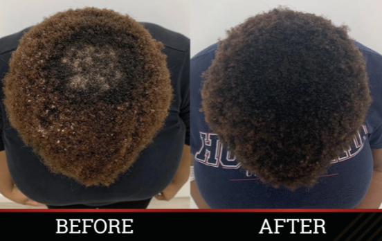 X-tra Strength Herbal Growth Oil