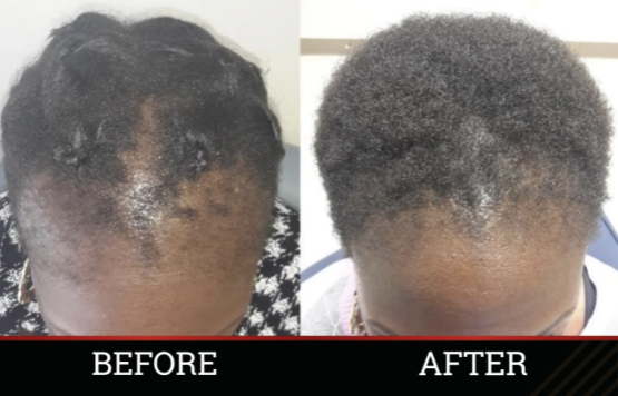 X-tra Strength Herbal Growth Oil