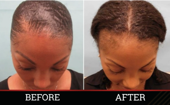 X-tra Strength Herbal Growth Oil
